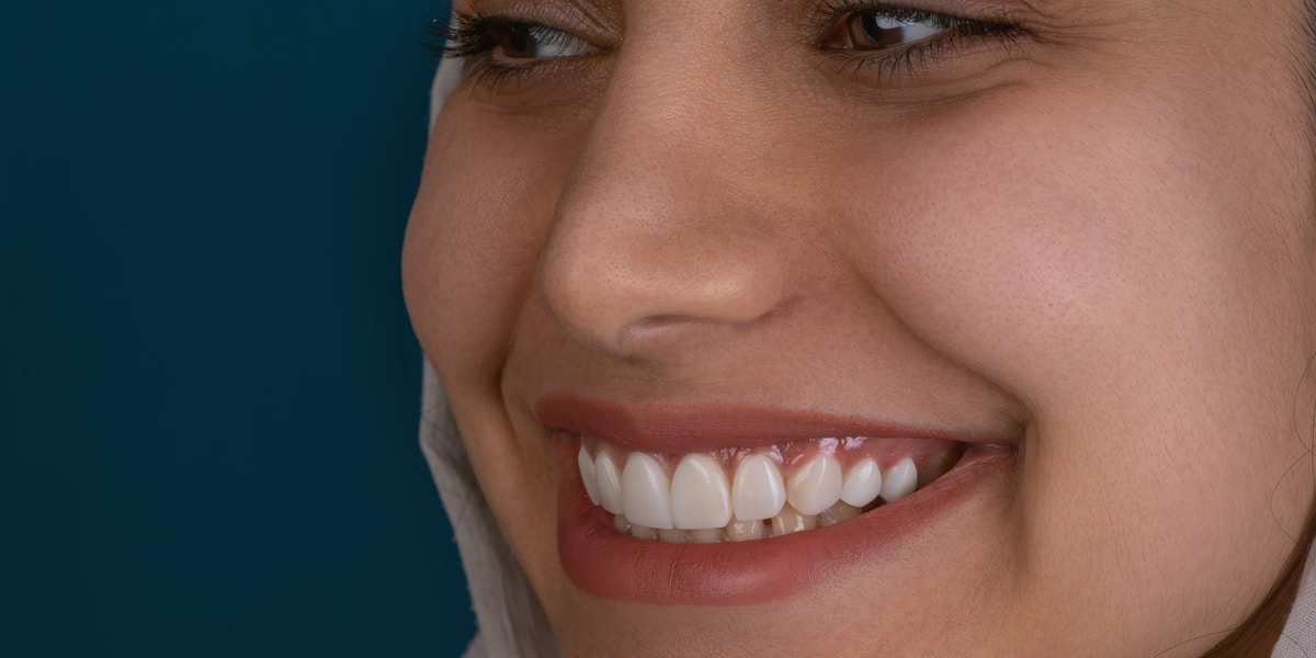 Dental implant insurance coverage options